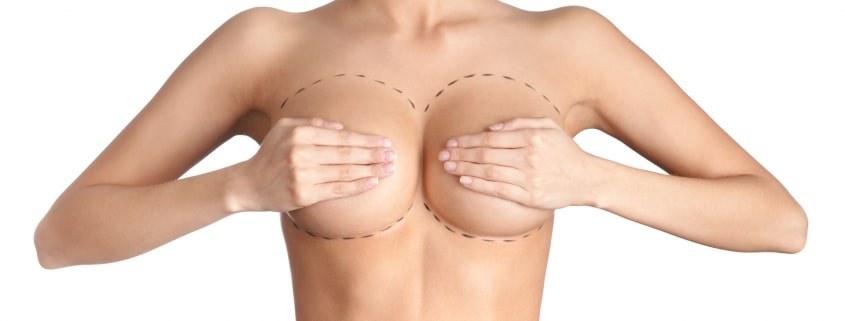 intervention chirurgicale pour les seins
