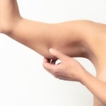 chirurgie des bras femme